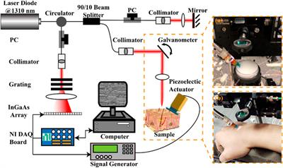 VP-net: an end-to-end deep learning network for elastic wave velocity prediction in human skin in vivo using optical coherence elastography